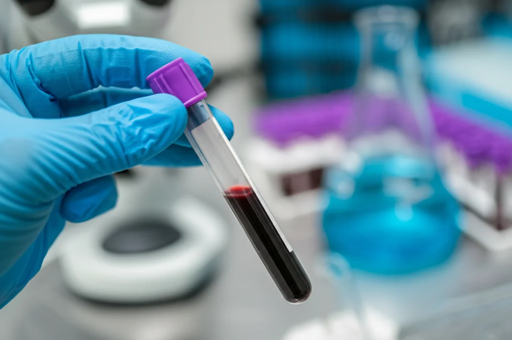 Macro fotografia di una provetta di sangue tenuta da una mano guantata in un laboratorio, con sfondo sfocato di attrezzature mediche. Lente macro 100mm, alta definizione, illuminazione controllata da laboratorio.