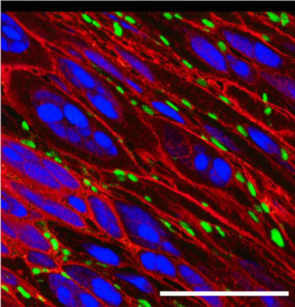 Immagine di microscopia a fluorescenza di una sezione di tessuto aortico umano con dissezione. Si vedono i nuclei cellulari colorati in blu (DAPI), le cellule muscolari lisce in rosso (SMA) e uno dei geni hub (es. CAPZB) in verde (Alexa Fluor 488). Evidente la disorganizzazione tissutale. Obiettivo ad alta magnificazione (es. 40x), illuminazione specifica per fluorescenza, immagine nitida con colori vibranti.
