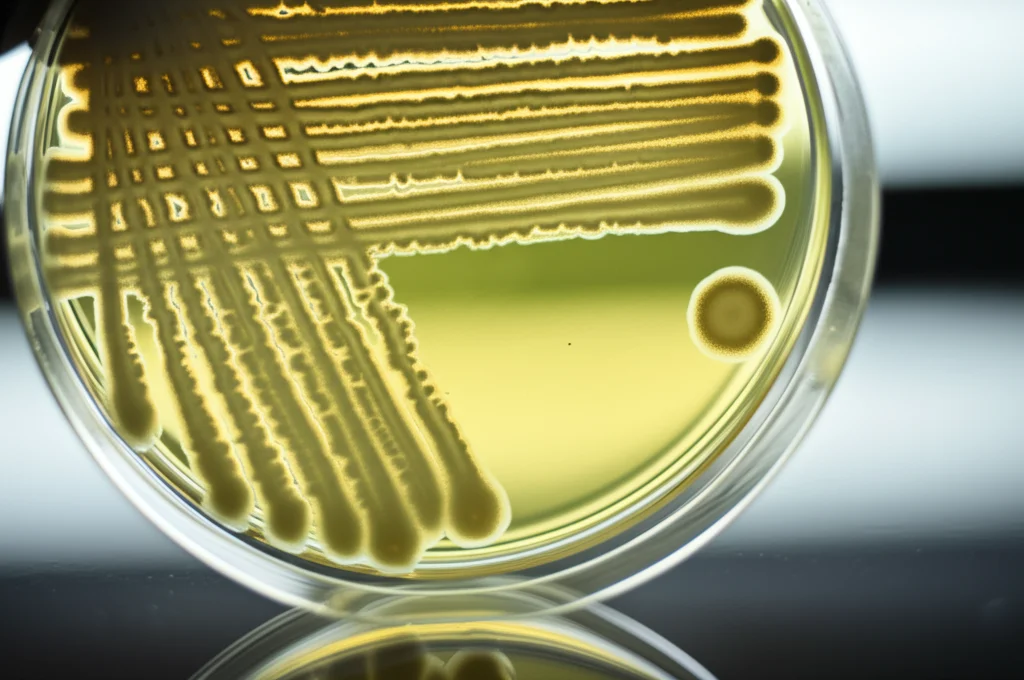 Macro fotografia di colonie batteriche di Klebsiella pneumoniae su una piastra di Petri in un laboratorio. Obiettivo macro 100mm, alta definizione, illuminazione controllata per evidenziare la consistenza mucoide delle colonie.