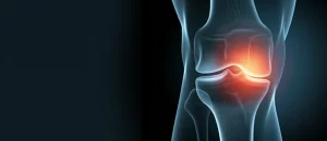 Modello anatomico dettagliato che mostra la muscolatura della coscia e del ginocchio accanto a una radiografia che evidenzia l'osteoartrosi, focus nitido sulla cartilagine e sull'osso, illuminazione da studio controllata, obiettivo macro 100mm, alta definizione, profondità di campo.