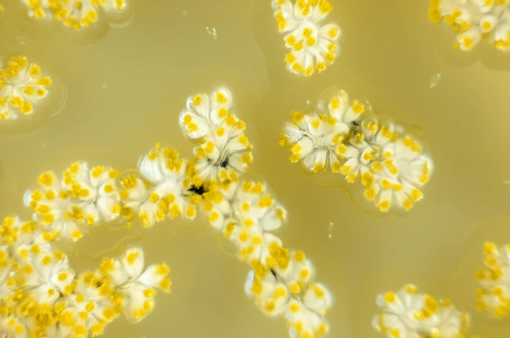 Primo piano macro di un callo di Nigella sativa di colore giallastro-bianco in una piastra di Petri trasparente, su un terreno di coltura gelatinoso. Illuminazione da laboratorio controllata per evidenziare la texture cellulare. Obiettivo macro 100mm, alta definizione, messa a fuoco precisa.