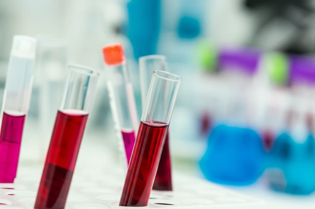 Primo piano di provette di sangue in un laboratorio di analisi mediche, luce controllata, macro lens 100mm, high detail, precise focusing, sfondo leggermente sfocato con attrezzatura scientifica.