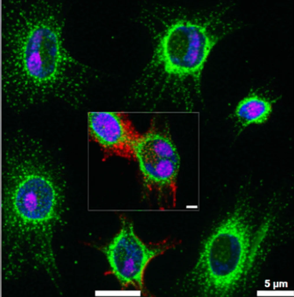 Immagini di microscopia a fluorescenza di cellule U2OS trattate con Sunitinib Malato, visualizzate con CPP. Obiettivo 100mm macro, alta risoluzione. Si notano aggregati intensamente colorati nel canale dei lisosomi (viola), insieme a perturbazioni visibili nel reticolo endoplasmatico (verde) e nel Golgi (giallo), indicando effetti multipli del composto.