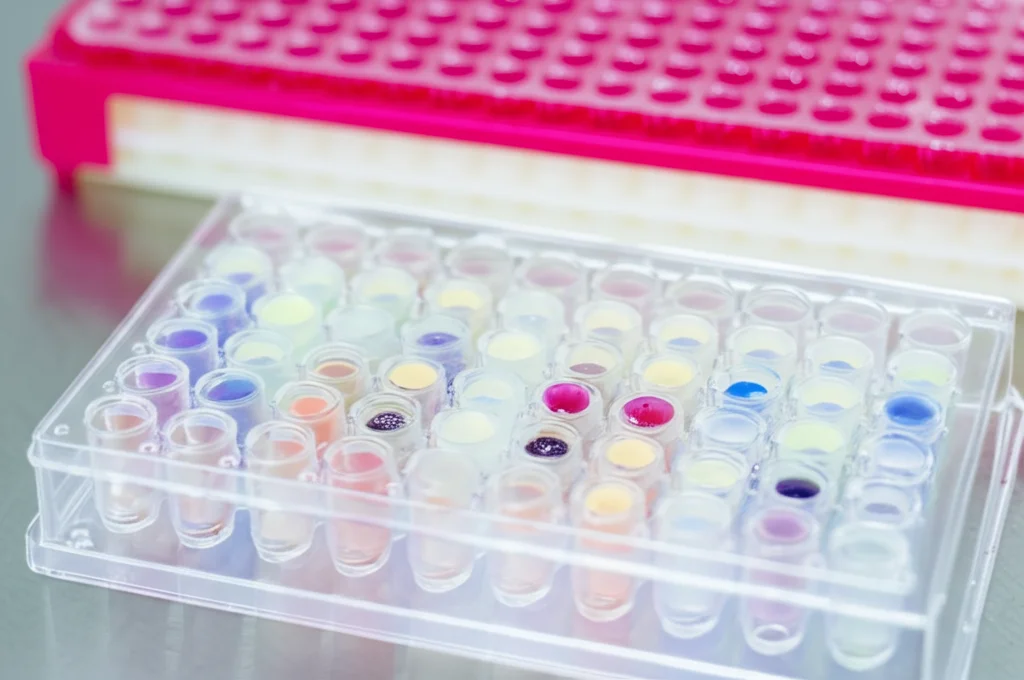 Primo piano di una piastra ELISA a 96 pozzetti in un laboratorio di ricerca, con pipette e provette sullo sfondo sfocato. Luce da laboratorio controllata, obiettivo macro 100mm, focus preciso sui pozzetti colorati che indicano i risultati del test UCN2, alta definizione.