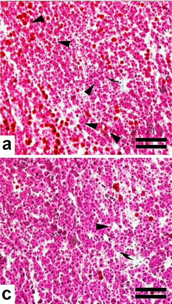 Sezione coronale di cervello di topo modello Alzheimer (App) visualizzata al microscopio. Evidenziate in rosso numerose placche di beta-amiloide diffuse nella corteccia e nell'ippocampo. Immagine ad alta risoluzione, focus nitido sulle placche. Obiettivo 20x.