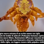 Immagine macro estrema di un occhio umano con ciglia infestate da lendini di pidocchi (Pediculus humanus capitis), obiettivo macro 90mm, illuminazione diffusa per massimo dettaglio, che mostra le piccole uova biancastre attaccate saldamente ai peli delle ciglia, con leggero rossore della palpebra visibile.