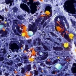 Immagine macro altamente dettagliata di cellule di carcinoma orale squamoso (OSCC) con evidenza di lipopolisaccaridi batterici (LPS) intracellulari che innescano la piroptosi. L'immagine dovrebbe mostrare la struttura cellulare compromessa e il rilascio di citochine infiammatorie, con un'illuminazione drammatica e controllata per enfatizzare la natura aggressiva del fenotipo tumorale. Obiettivo macro 100mm, alta definizione, focus preciso.