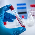 Primo piano di una provetta di sangue tenuta da una mano guantata in un laboratorio, con attrezzature mediche sfocate sullo sfondo. Illuminazione da studio controllata, obiettivo macro 90mm per dettaglio elevato sulla provetta, a simboleggiare l'analisi del fosforo sierico per l'ictus.