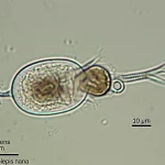 Macro lens, 105mm, high detail, precise focusing, controlled lighting, view of Rodentolepis nana egg under a microscope with a scale bar