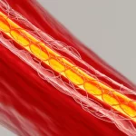 Immagine macro di un bypass coronarico sano e pervio, con flusso sanguigno visibile, illuminazione laterale per creare profondità e dettaglio, obiettivo macro 100mm, alta definizione, sfondo neutro per concentrarsi sul graft.
