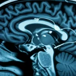 Photorealistic image of a brain scan showing a deep brain stimulation electrode near the subthalamic nucleus, macro lens, 100mm, high detail, controlled lighting.