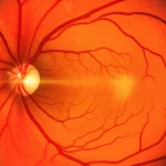 Un'immagine macro altamente dettagliata di una retina oculare, con focus sulla macula, che mostra i vasi sanguigni. L'illuminazione è controllata per evidenziare la complessità della struttura, simboleggiando la ricerca avanzata nel trattamento della nAMD. Obiettivo macro, 90mm, alta definizione, illuminazione da studio.