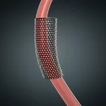 Primo piano macro di uno stent medico flessibile posizionato all'interno di un modello anatomico trasparente di un cuore neonatale con dotto arterioso pervio visibile, illuminazione drammatica laterale per evidenziare la struttura dello stent, alta definizione, sfondo scuro.