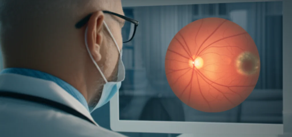 Photorealistic image of a doctor looking at a digital display showing a retinal fundus image with potential AMD lesions highlighted, 35mm portrait lens, controlled lighting.