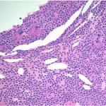 Visualizzazione microscopica ad alta risoluzione di tessuto epatico di ratto, con focus su epatociti sani accanto ad aree con danno indotto da doxorubicina (degenerazione balloniforme e necrosi) parzialmente protette dall'alamandina, illuminazione da laboratorio controllata, obiettivo macro 60mm.