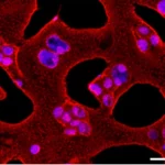 High detail macro lens 100mm image showing stained cell nuclei with visible dots, representing AgNORs, under controlled lighting.