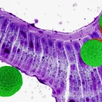 Immagine concettuale fotorealistica di ioni di rame che inducono la cuproptosi in cellule di glioma, con dettagli molecolari visibili all'interno dei mitocondri, obiettivo macro 105mm, illuminazione da studio per evidenziare la struttura cellulare e l'interazione specifica del rame con le proteine lipoilate.