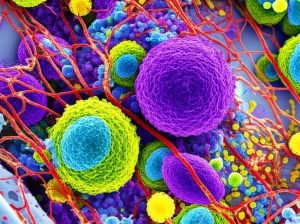 Visualizzazione 3D altamente dettagliata del microambiente tumorale del linfoma EBV+, con cellule tumorali (viola scuro) che interagiscono con diverse popolazioni di cellule immunitarie (verdi, blu, gialle) e una rete di vasi sanguigni (rossi). L'immagine dovrebbe avere un aspetto fotorealistico, come se fosse ottenuta da un microscopio confocale avanzato, con una profondità di campo che mette a fuoco alcune cellule mentre altre sono leggermente sfocate sullo sfondo. Illuminazione da laboratorio, lente macro 100mm, alta definizione.