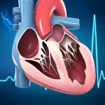 Illustrazione medica dettagliata di un cuore umano affetto da stenosi aortica severa, con particolare enfasi sull'intervallo QT visibile su un elettrocardiogramma stilizzato in sottofondo e simboli che rappresentano l'iperattività del sistema nervoso simpatico. Obiettivo macro 70mm, alta definizione, illuminazione drammatica per evidenziare la patologia.