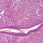 Microscopic image of healthy ovarian tissue showing multiple follicles at different stages of development, macro lens, 105mm, high detail, precise focusing.