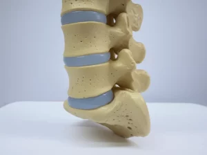 Modello anatomico dettagliato della colonna vertebrale lombare che mostra chiaramente un'ernia del disco tra due vertebre, illuminazione da studio controllata e precisa, lente macro 100mm per massima definizione dei dettagli, sfondo neutro e pulito.
