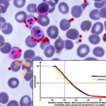 Immagine concettuale di una goccia di sangue analizzata al microscopio, con evidenza di neutrofili (globuli bianchi con nucleo segmentato) e molecole di albumina fluttuanti, accanto a un grafico stilizzato che mostra un aumento del rischio (curva a J). Obiettivo macro 90mm, alta definizione, illuminazione da laboratorio controllata, focus preciso sui componenti del sangue e sul grafico.