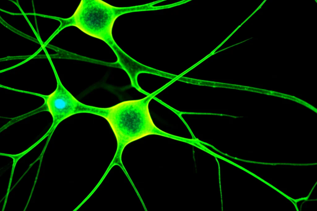 Immagine macro di neuroni cerebrali umani visualizzati con tecnica di microscopia a fluorescenza, obiettivo macro 100mm, con dettagli precisi delle sinapsi e dei corpi cellulari, illuminazione controllata per evidenziare le strutture, in un contesto di ricerca sull'epilessia.