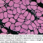 Immagine macro fotorealistica di calcoli biliari non di colesterolo, con alcuni che mostrano al loro interno inclusioni scure che potrebbero rappresentare uova di parassita calcificate. L'illuminazione è controllata per evidenziare la texture e i dettagli dei calcoli, obiettivo macro 60mm, alta definizione, sfondo scuro per contrasto.