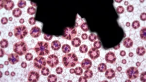 Immagine macro ad alta definizione di cellule di adenoma ipofisario al microscopio, illuminazione controllata, messa a fuoco precisa su nuclei cellulari, 60mm macro lens, high detail, che mostra differenze potenziali tra zone diverse del tumore, magari con colorazione immunoistochimica evidente.