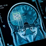 Close-up of a medical MRI scan with an artificial intelligence overlay highlighting areas of interest, 100mm Macro lens, high detail, precise focusing