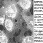 Immagine al microscopio ad alta risoluzione del microambiente tumorale del carcinoma orale derivato da fibrosi sottomucosa. Si osservano macrofagi INHBA+ (evidenziati con fluorescenza rossa) e fibroblasti associati al cancro (CAF) pro-infiammatori (fluorescenza verde) che interagiscono con cellule T regolatorie (fluorescenza blu), creando un ambiente immunosoppressivo. Macro lens, 100mm, high detail, precise focusing, controlled lighting, con colori distintivi per le diverse popolazioni cellulari per chiarezza scientifica e profondità di campo.