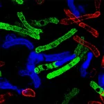Visualizzazione scientifica fotorealistica al microscopio a fluorescenza di corpi inclusi di huntingtina eterogenei nella corteccia cerebrale umana affetta da Malattia di Huntington. Colori vivaci (verde, rosso, blu) indicano il legame di diversi anticorpi specifici (EM48, EPR, MW1), mostrando co-localizzazione e inclusioni singolarmente marcate. Dettaglio elevato, messa a fuoco nitida sulle strutture proteiche aggregate, sfondo scuro per contrasto, obiettivo 60mm macro.