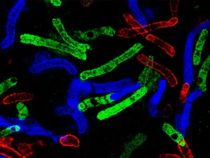 Visualizzazione scientifica fotorealistica al microscopio a fluorescenza di corpi inclusi di huntingtina eterogenei nella corteccia cerebrale umana affetta da Malattia di Huntington. Colori vivaci (verde, rosso, blu) indicano il legame di diversi anticorpi specifici (EM48, EPR, MW1), mostrando co-localizzazione e inclusioni singolarmente marcate. Dettaglio elevato, messa a fuoco nitida sulle strutture proteiche aggregate, sfondo scuro per contrasto, obiettivo 60mm macro.