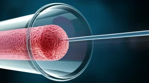 Immagine medica concettuale che mostra un catetere avanzare delicatamente all'interno di una vena umana traslucida per raggiungere un trombo rosso vivo, con particelle di farmaco (rhPro-UK) che vengono rilasciate e iniziano a dissolvere il coagulo, sfondo scuro per enfatizzare il vaso, illuminazione focalizzata sul trombo e sul catetere, obiettivo macro 100mm, alta definizione.