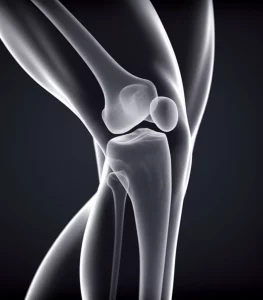 Un'immagine concettuale del ginocchio umano, prime lens 35mm, con la rotula evidenziata e leggermente inclinata lateralmente. Sottili linee di luce indicano le forze di pressione anomale che si estendono dalla rotula al piatto tibiale, in particolare alla regione centrale mediale e posteriore laterale. Sfondo scuro per far risaltare il ginocchio, depth of field, stile quasi da film noir con illuminazione drammatica.