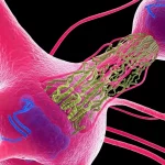 Visualizzazione 3D fotorealistica di aggregati di proteina alfa-sinucleina interagenti con le membrane associate ai mitocondri (MAM) all'interno di un neurone, evidenziando la disorganizzazione dei lipidi; stile macro con profondità di campo ridotta, illuminazione drammatica che enfatizza il contatto ER-mitocondri, obiettivo 85mm, high detail.