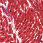 Immagine fotorealistica di un tessuto cardiaco in 2D che mostra miociti (cellule muscolari cardiache) e fibroblasti (cellule di tessuto connettivo). Evidenziazione delle connessioni non locali dei fibroblasti attraverso una regione di cicatrice. Obiettivo macro 100mm, alta definizione, illuminazione da studio per dettagli precisi delle interazioni cellulari e della struttura tissutale.