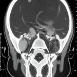 Photorealistic medical CT scan reconstruction displaying intricate anatomical details, captured with high detail and precise focusing under controlled lighting conditions.