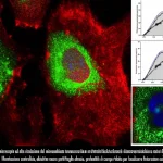 Visualizzazione al microscopio ad alta risoluzione del microambiente tumorale del cancro alla vescica muscolo-invasivo. Cellule tumorali (viola) circondate da fibroblasti attivati (verdi) e cellule T infiltranti (rosse). Illuminazione controllata, obiettivo macro 100mm per dettaglio elevato, profondità di campo ridotta per focalizzare l'interazione cellulare.