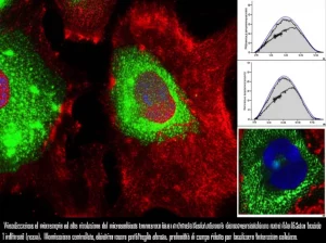 Visualizzazione al microscopio ad alta risoluzione del microambiente tumorale del cancro alla vescica muscolo-invasivo. Cellule tumorali (viola) circondate da fibroblasti attivati (verdi) e cellule T infiltranti (rosse). Illuminazione controllata, obiettivo macro 100mm per dettaglio elevato, profondità di campo ridotta per focalizzare l'interazione cellulare.