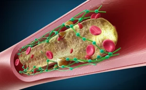 Visualizzazione artistica ma scientificamente accurata di una sezione trasversale di un'arteria con placca aterosclerotica parzialmente ridotta. Molecole di quercetina (strutture chimiche stilizzate) interagiscono con le cellule endoteliali e i macrofagi sulla parete interna. Illuminazione drammatica che evidenzia la placca e le molecole. Stile fotorealistico con profondità di campo, obiettivo prime 35mm.