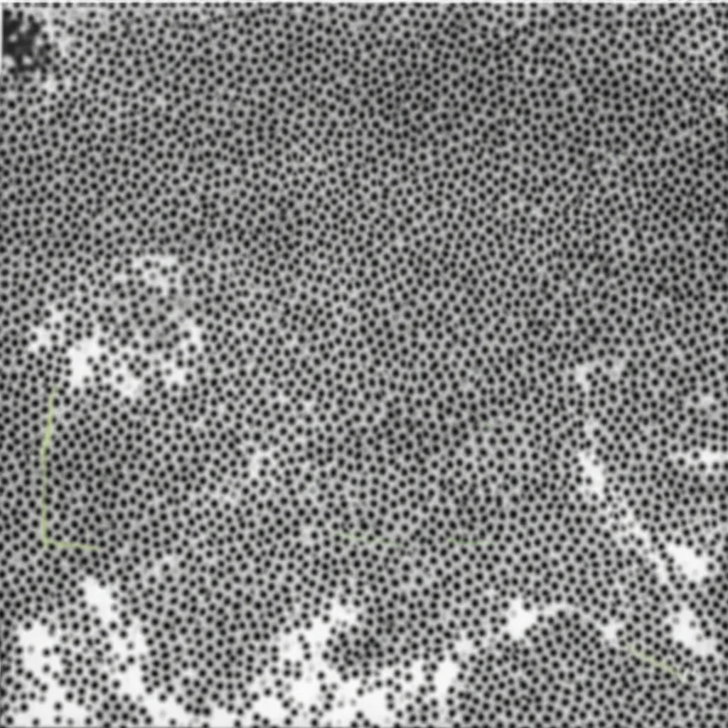 Immagine fotorealistica di cellule immunitarie (linfociti T in rosso brillante, macrofagi in verde) che infiltrano un tessuto tumorale (blu scuro). Vista al microscopio ad alta potenza, obiettivo macro 100mm, illuminazione controllata per evidenziare le interazioni cellulari, alta definizione.