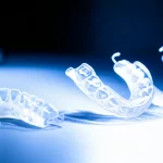 Immagine fotorealistica di tre diversi tipi di bite dentali (occlusal devices) su un tavolo da laboratorio illuminato professionalmente. Un bite è visibilmente realizzato con stampa 3D mostrando sottili strati, un altro è liscio e traslucido tipico della fresatura, e il terzo ha l'aspetto classico di un bite convenzionale. Obiettivo macro da 85mm, alta definizione per evidenziare le texture, illuminazione controllata.