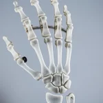 Immagine macro di una protesi totale di polso moderna, con dettagli metallici e in PEEK, illuminazione da studio controllata, alta definizione, su sfondo neutro sfocato per enfatizzare l'impianto. Obiettivo macro 100mm, messa a fuoco precisa.