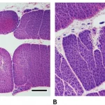 Immagine macro ad alta definizione di un testicolo di topo sezionato che mostra i tubuli seminiferi, con alcune aree che evidenziano vacuolizzazione e atrofia, accanto a un testicolo sano per confronto. Illuminazione controllata e precisa messa a fuoco per evidenziare i dettagli cellulari e tissutali, obiettivo macro 105mm.