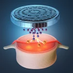 Immagine concettuale altamente realistica di una nanopiattaforma avanzata che rilascia agenti terapeutici (SIRT1 e SOX9) all'interno di un disco intervertebrale umano stilizzato, evidenziando la rigenerazione cellulare e la riduzione dell'infiammazione. Illuminazione drammatica, profondità di campo, obiettivo 50mm, toni blu freddi per la tecnologia e accenti arancioni/rossi caldi per la rigenerazione e l'infiammazione controllata.