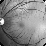 Immagine fotorealistica di una scansione OCT della retina umana, obiettivo macro 80mm, alta definizione, che mostra pattern strutturali complessi legati all'invecchiamento, illuminazione controllata e precisa messa a fuoco.