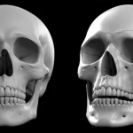 A photorealistic image contrasting two 3D medical models of a human skull: one with a large defect on the side, the other fully reconstructed with a cranioplasty plate. Macro lens, 100mm, high detail, controlled lighting.
