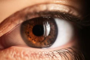Primo piano di un occhio umano affetto da sindrome di Sjögren, con segni visibili di secchezza e infiammazione sulla congiuntiva e sulla cornea. Luce laterale per accentuare la texture della superficie oculare, lente macro 105mm, alta definizione, profondità di campo ridotta per isolare l'occhio e suggerire la complessità della condizione.