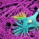Visualizzazione 3D ad alta risoluzione di sinapsi neuronali umane, con placche di amiloide-beta patologica (magenta) che interagiscono con strutture pre-sinaptiche (ciano) e post-sinaptiche (giallo), illuminazione drammatica, stile scientifico fotorealistico, obiettivo 63x olio.